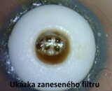 Zanesený filter načúvacieho prístroja vlhkosťou